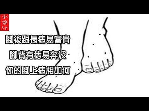 腳背有痣|腳上有痣是福相 女人有這3特點一生好運旺夫